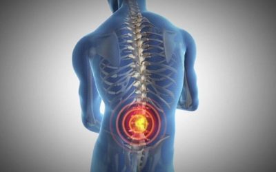 What is Ankylosing Spondylitis?