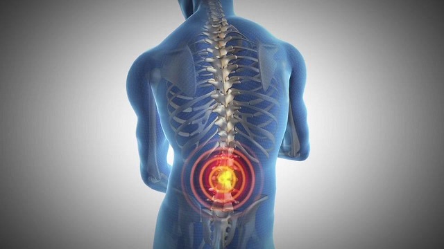 What is Ankylosing Spondylitis?