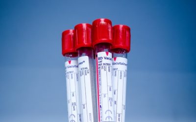 What is HLA-B27 Blood Test?